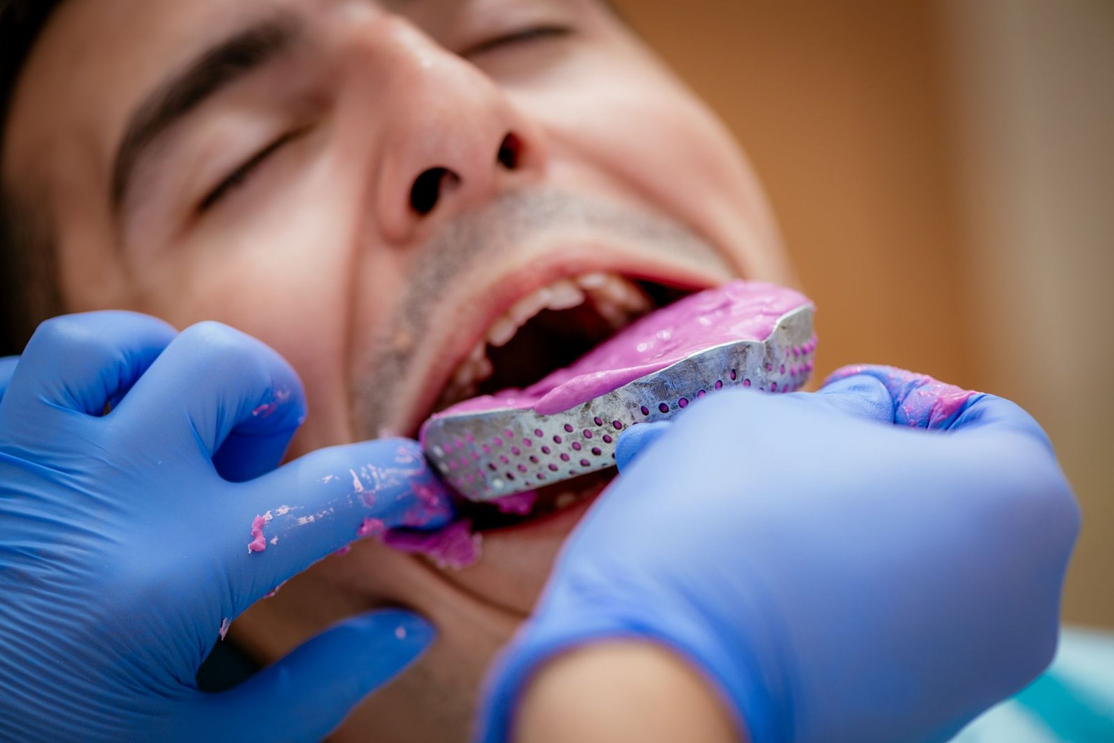 impresión dental para preparar tratamientos dentales con prótesis
