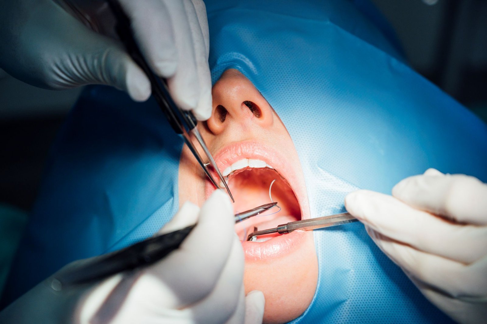 tratamientos de cirugía oral