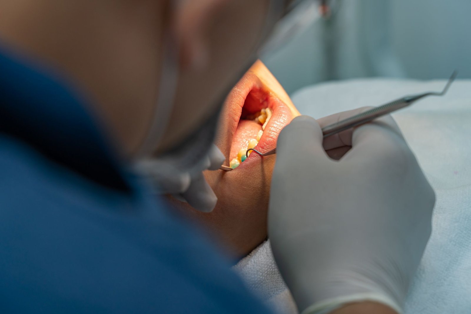 tratamiento enfermedad periodontal Granada