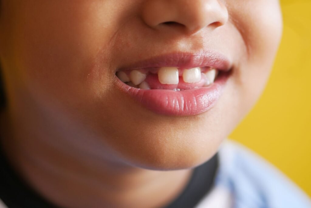 recambio dental en niños