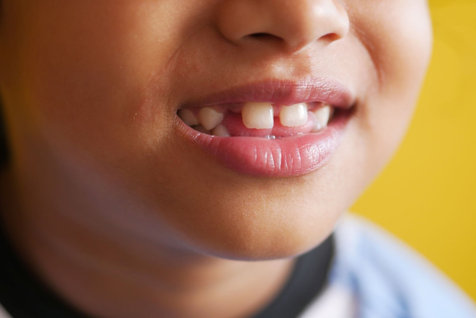 recambio dental en niños