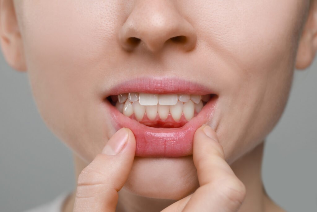 encías inflamadas